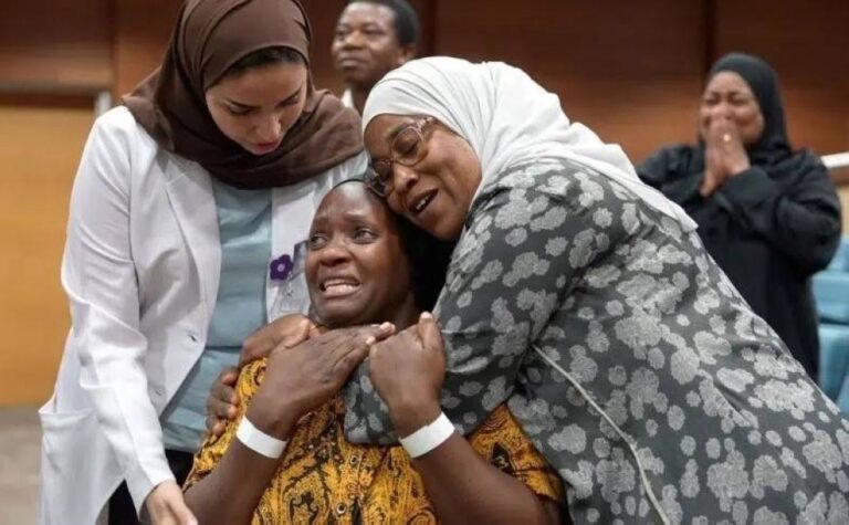 نجاح-عملية-فصل-التوأم-التنزاني-نانسي-ونايس
