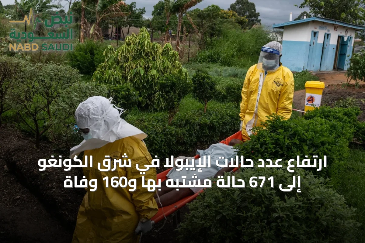 ارتفاع عدد حالات الإيبولا في شرق الكونغو إلى 671 حالة مشتبه بها و160 وفاة