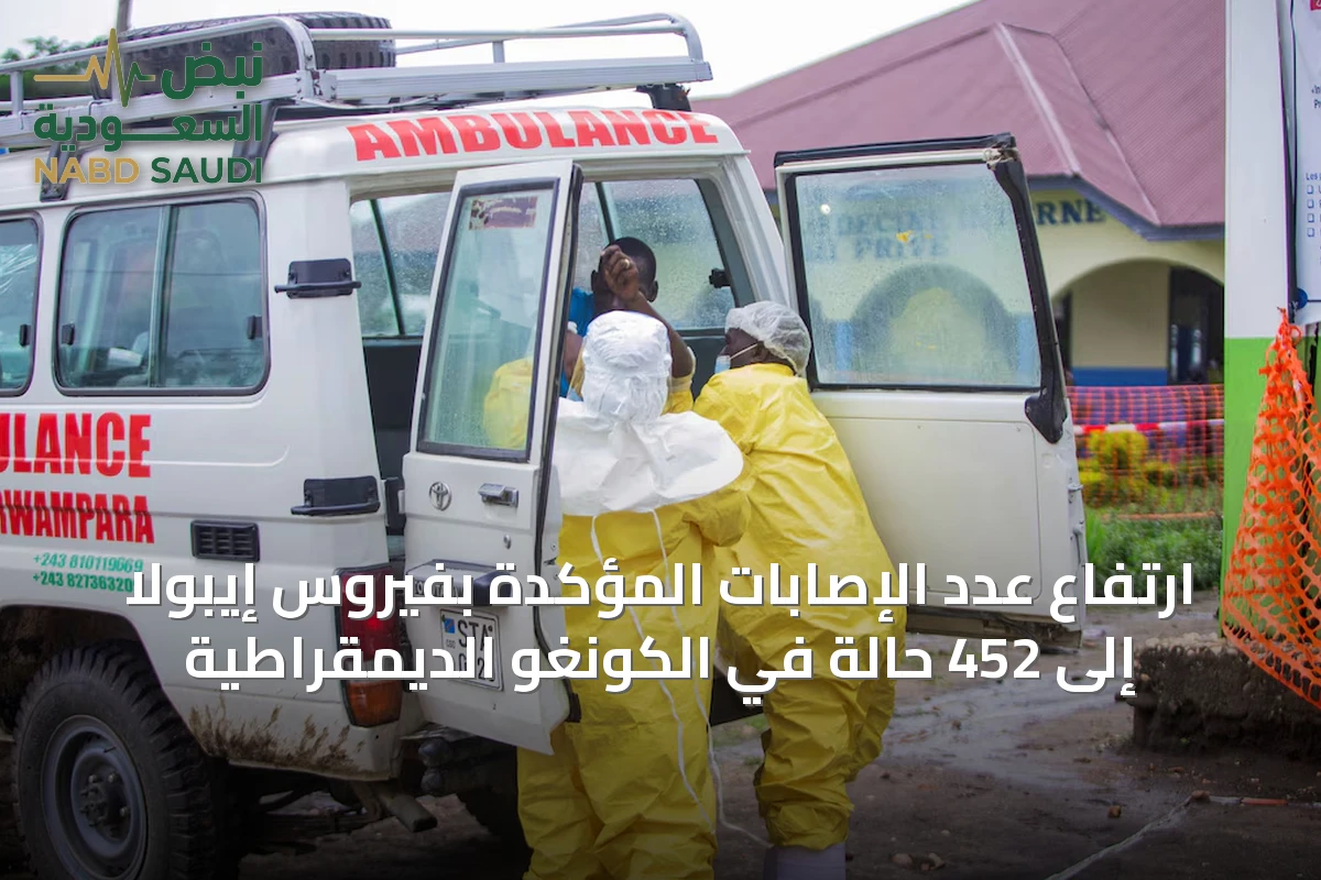ارتفاع عدد الإصابات المؤكدة بفيروس إيبولا إلى 452 حالة في الكونغو الديمقراطية