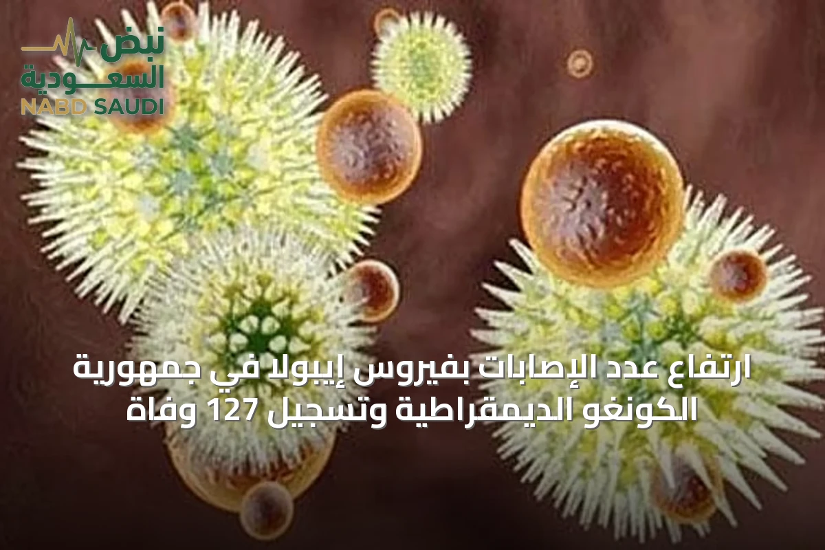 ارتفاع عدد الإصابات بفيروس إيبولا في جمهورية الكونغو الديمقراطية وتسجيل 127 وفاة