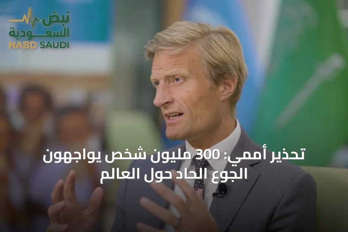 تحذير أممي: 300 مليون شخص يواجهون الجوع الحاد حول العالم