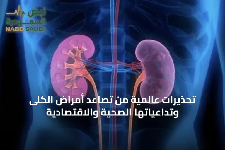 تحذيرات عالمية من تصاعد أمراض الكلى وتداعياتها الصحية والاقتصادية