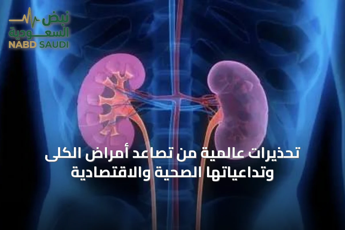 تحذيرات عالمية من تصاعد أمراض الكلى وتداعياتها الصحية والاقتصادية