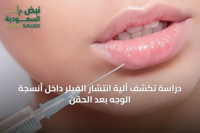 دراسة تكشف آلية انتشار الفيلر داخل أنسجة الوجه بعد الحقن