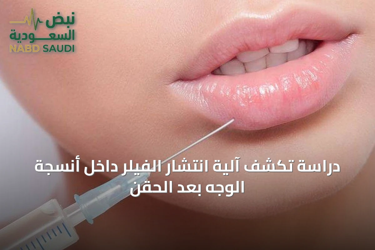 دراسة تكشف آلية انتشار الفيلر داخل أنسجة الوجه بعد الحقن