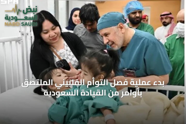 بدء عملية فصل التوأم الفلبيني الملتصق بأوامر من القيادة السعودية