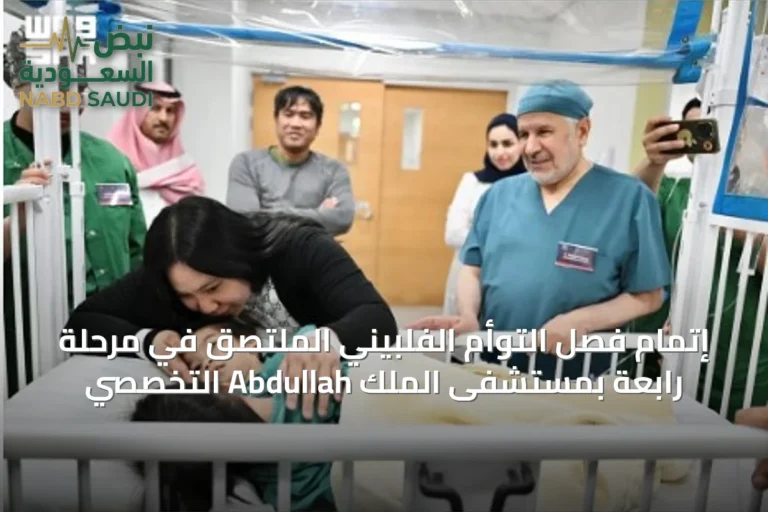 إتمام فصل التوأم الفلبيني الملتصق في مرحلة رابعة بمستشفى الملك Abdullah التخصصي