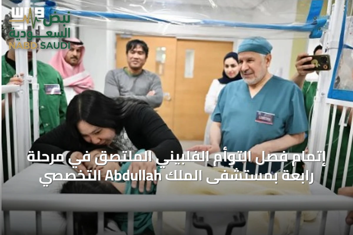 إتمام فصل التوأم الفلبيني الملتصق في مرحلة رابعة بمستشفى الملك Abdullah التخصصي