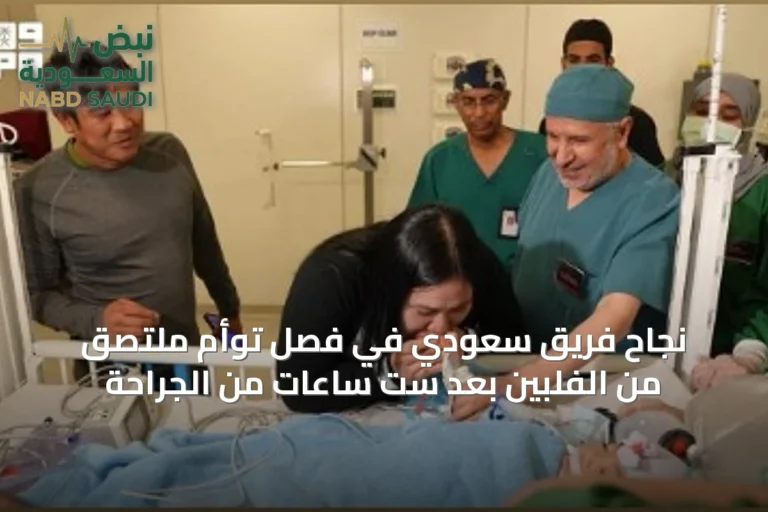 نجاح فريق سعودي في فصل توأم ملتصق من الفلبين بعد ست ساعات من الجراحة