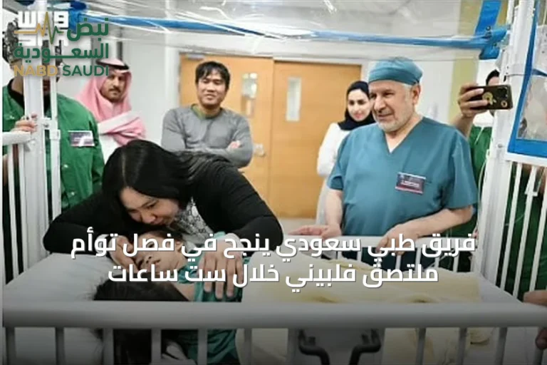 فريق طبي سعودي ينجح في فصل توأم ملتصق فلبيني خلال ست ساعات