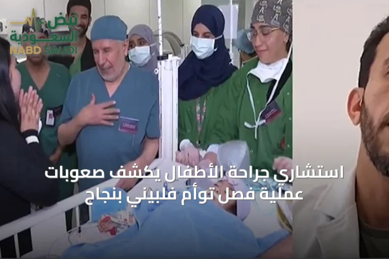 استشاري جراحة الأطفال يكشف صعوبات عملية فصل توأم فلبيني بنجاح