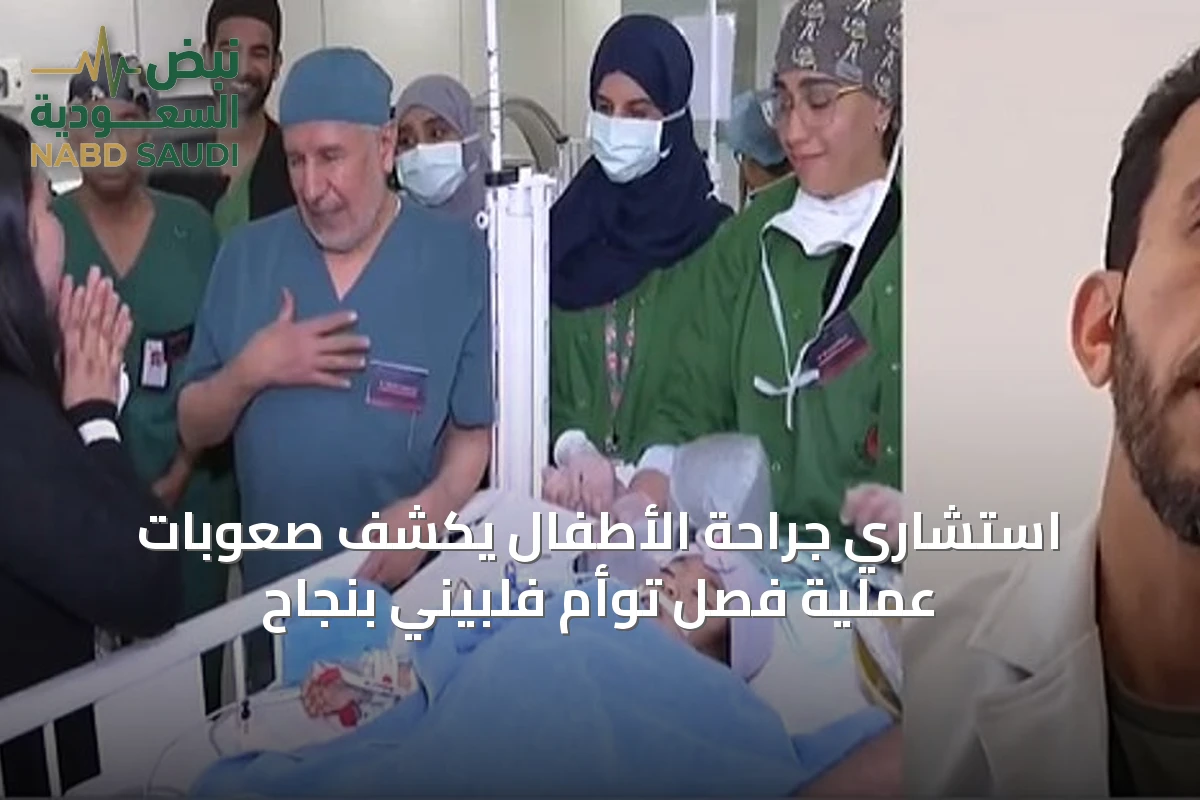 استشاري جراحة الأطفال يكشف صعوبات عملية فصل توأم فلبيني بنجاح
