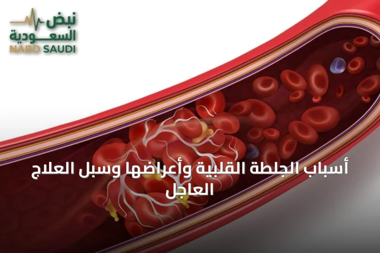 أسباب الجلطة القلبية وأعراضها وسبل العلاج العاجل