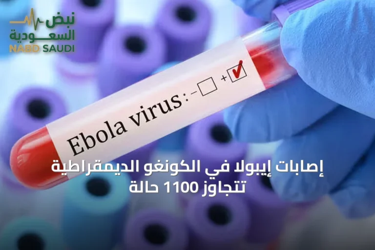 إصابات إيبولا في الكونغو الديمقراطية تتجاوز 1100 حالة