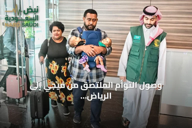 وصول التوأم الملتصق من فيجي إلى الرياض لدراسة حالتهما واستكشاف إمكانية فصلهما