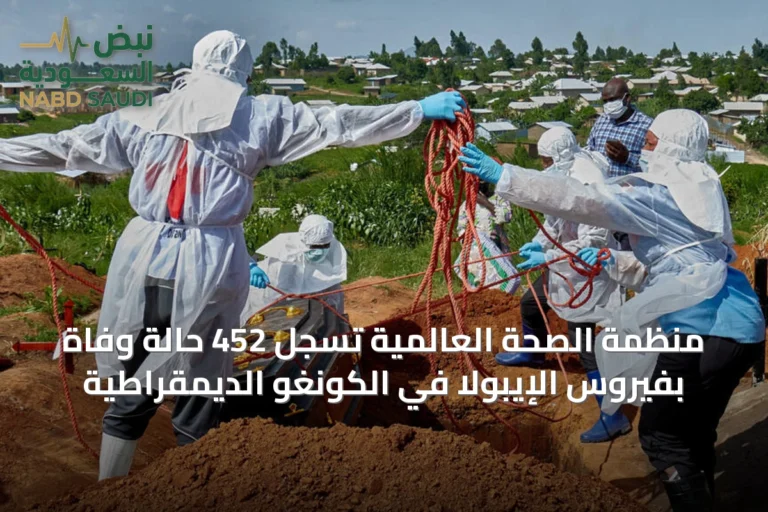 منظمة الصحة العالمية تسجل 452 حالة وفاة بفيروس الإيبولا في الكونغو الديمقراطية