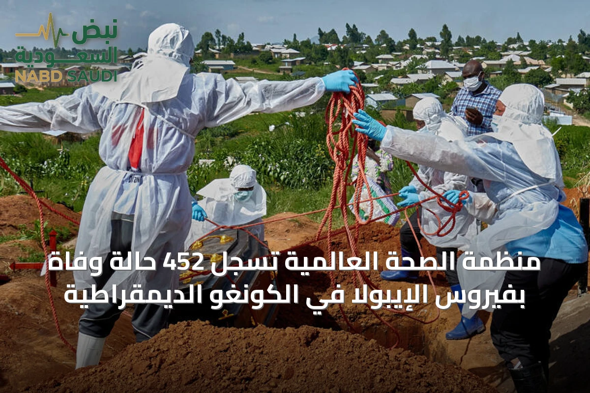 منظمة الصحة العالمية تسجل 452 حالة وفاة بفيروس الإيبولا في الكونغو الديمقراطية