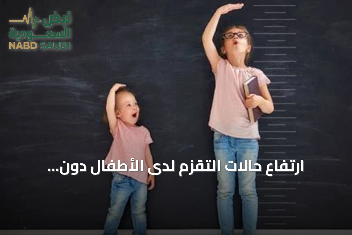 ارتفاع حالات التقزم لدى الأطفال دون الخامسة يثير قلق المختصين