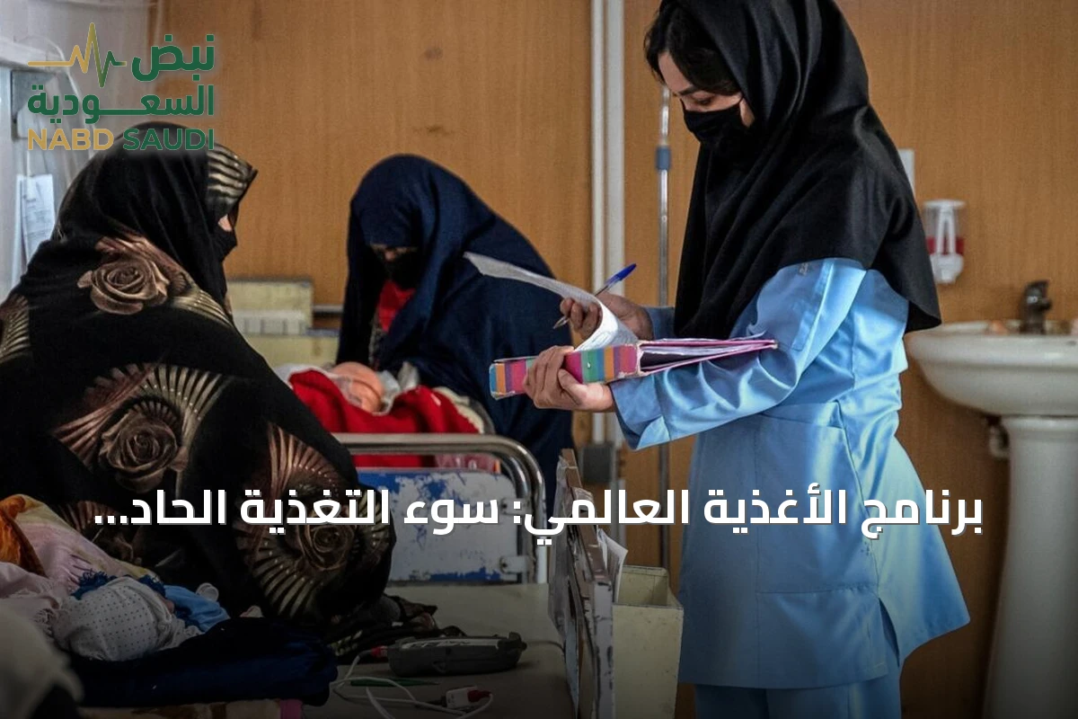 برنامج الأغذية العالمي: سوء التغذية الحاد بين الأطفال الأفغان وصل إلى مستويات خطيرة