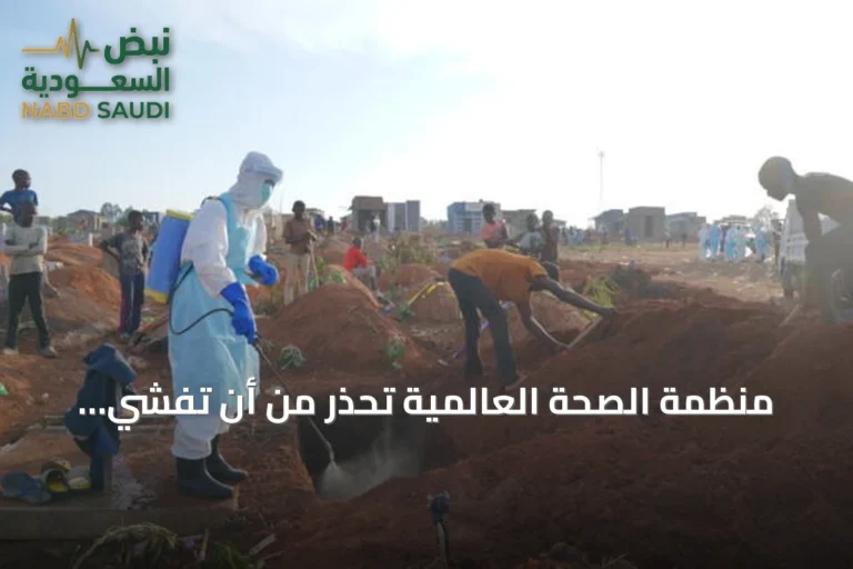 منظمة الصحة العالمية تحذر من أن تفشي إيبولا في الكونغو قد يصبح الأسوأ تاريخياً