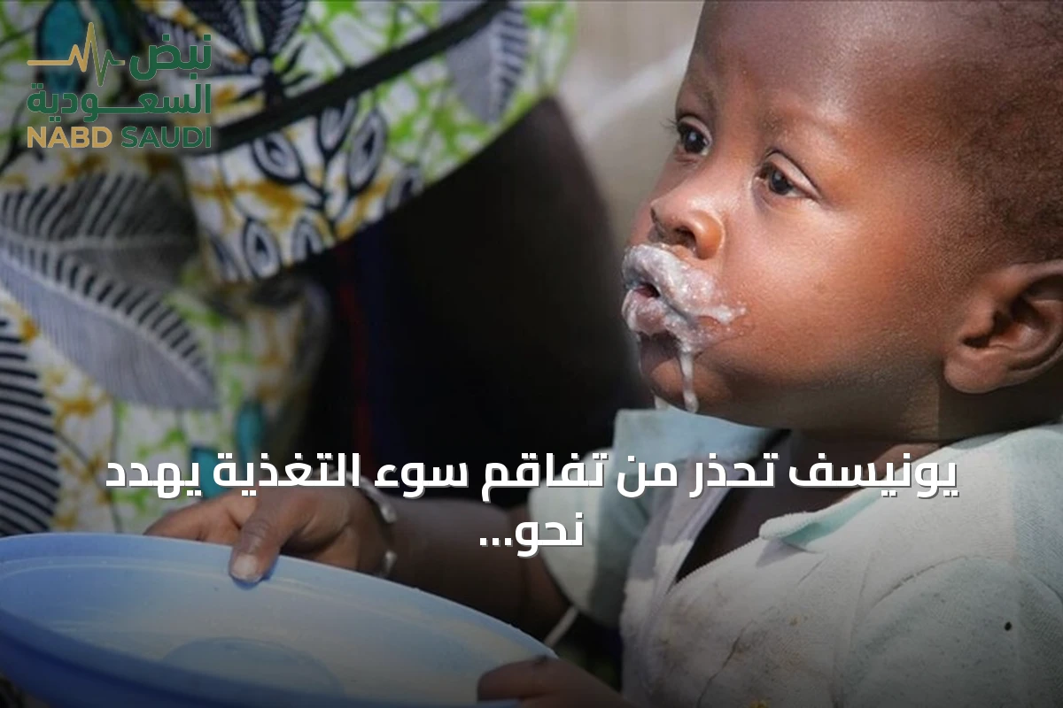 يونيسف تحذر من تفاقم سوء التغذية يهدد نحو مليوني طفل بالصومال