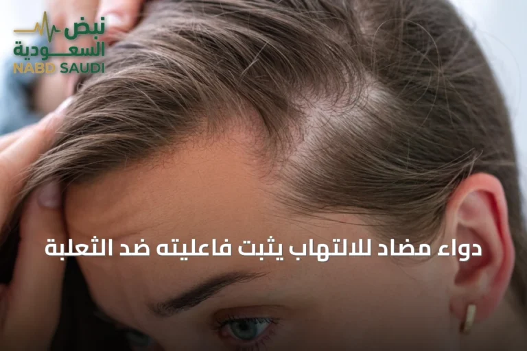دواء مضاد للالتهاب يثبت فاعليته ضد الثعلبة