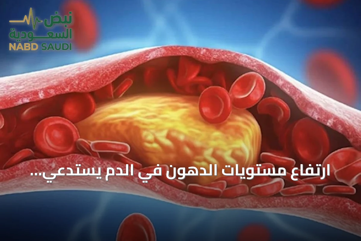 ارتفاع مستويات الدهون في الدم يستدعي متابعة صحية دورية