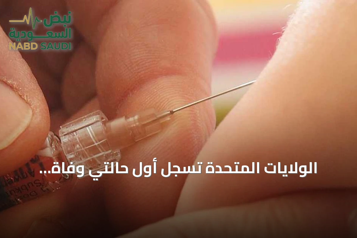 الولايات المتحدة تسجل أول حالتي وفاة بالحصبة في عام 2026