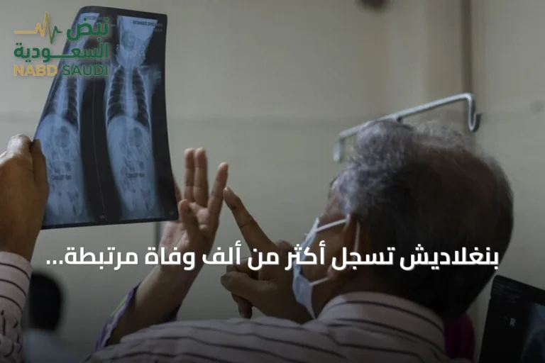 بنغلاديش تسجل أكثر من ألف وفاة مرتبطة بالحصبة بعد ارتفاع حالات الإصابات