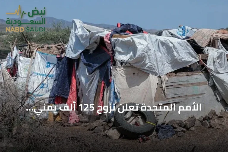 الأمم المتحدة تُعلن نزوح 125 ألف يمني جراء تصاعد القتال منذ سبتمبر
