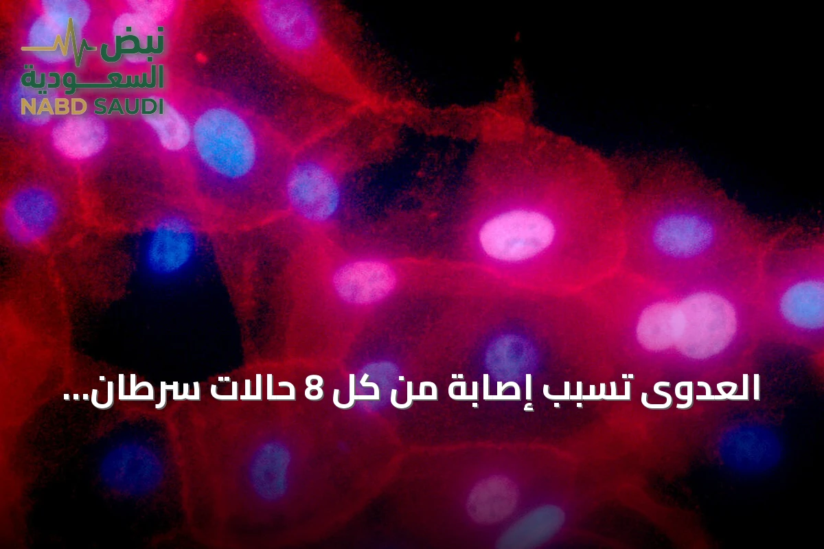 العدوى تسبّب إصابة من كل 8 حالات سرطان جديدة.. دراسة عالمية تكشف التفاصيل