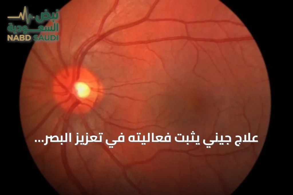 علاج جيني يثبت فعاليته في تعزيز البصر وإعادة بناء شبكية العين وفقًا لدراسة أمريكية