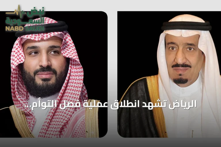 الرياض تشهد انطلاق عملية فصل التوأم الملتصق المغربي «سجى وضحى» بتوجيه من القيادة السعودية
