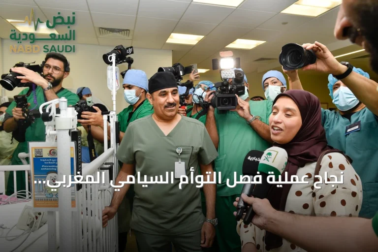 نجاح عملية فصل التوأم السيامي المغربي «سجى وضحى» في الرياض