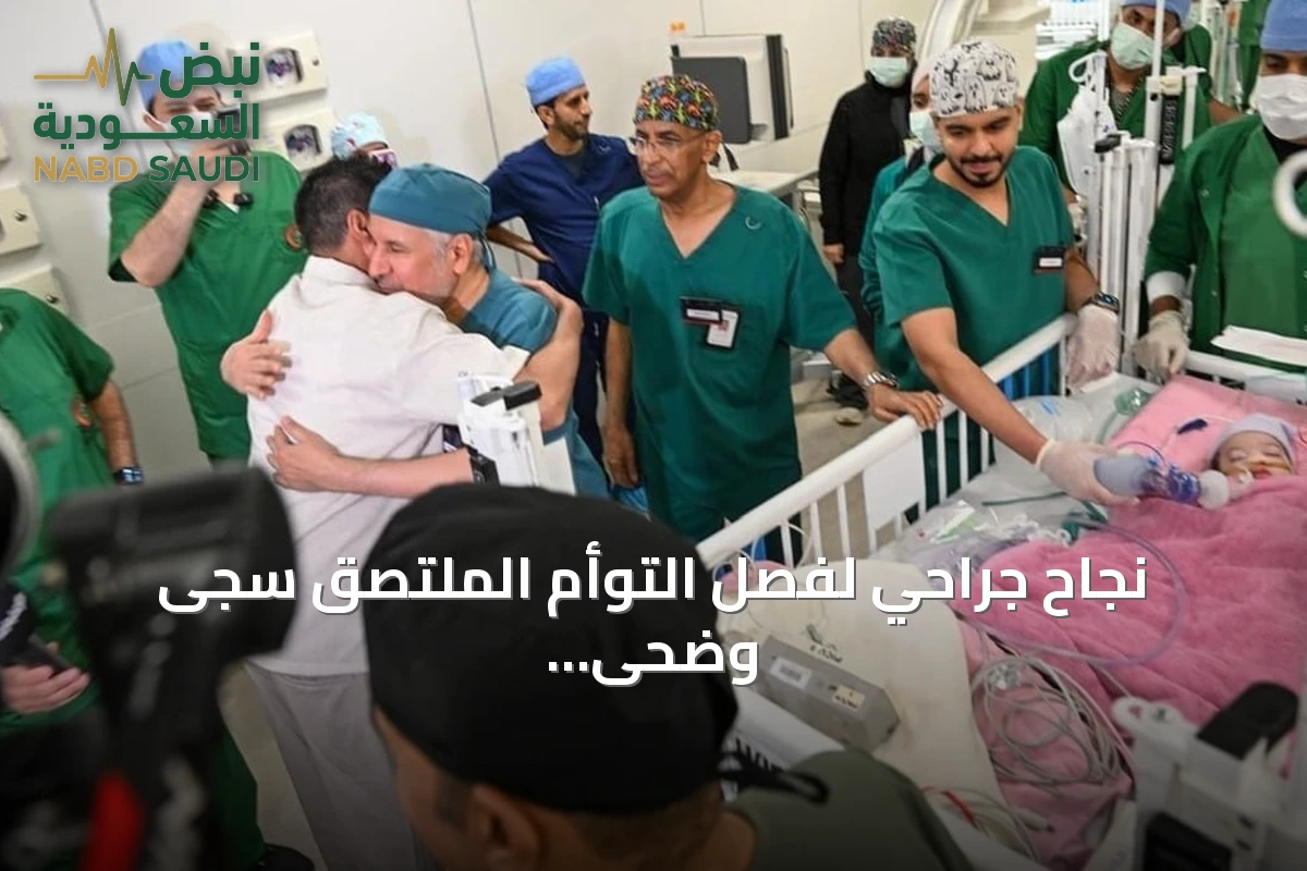 نجاح جراحي لفصل التوأم الملتصق سجى وضحى في مستشفى الملك Abdullah التخصصي للأطفال
