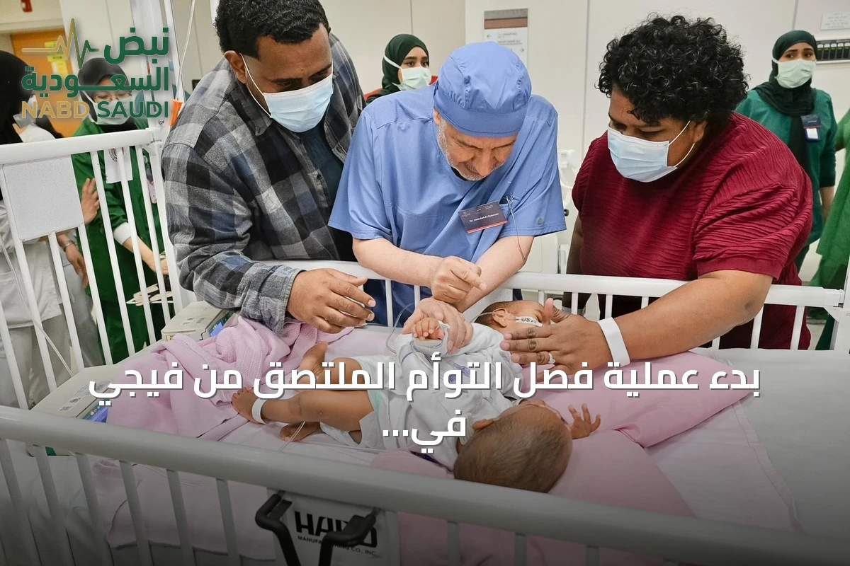بدء عملية فصل التوأم الملتصق من فيجي في الرياض بتوجيهات القيادة