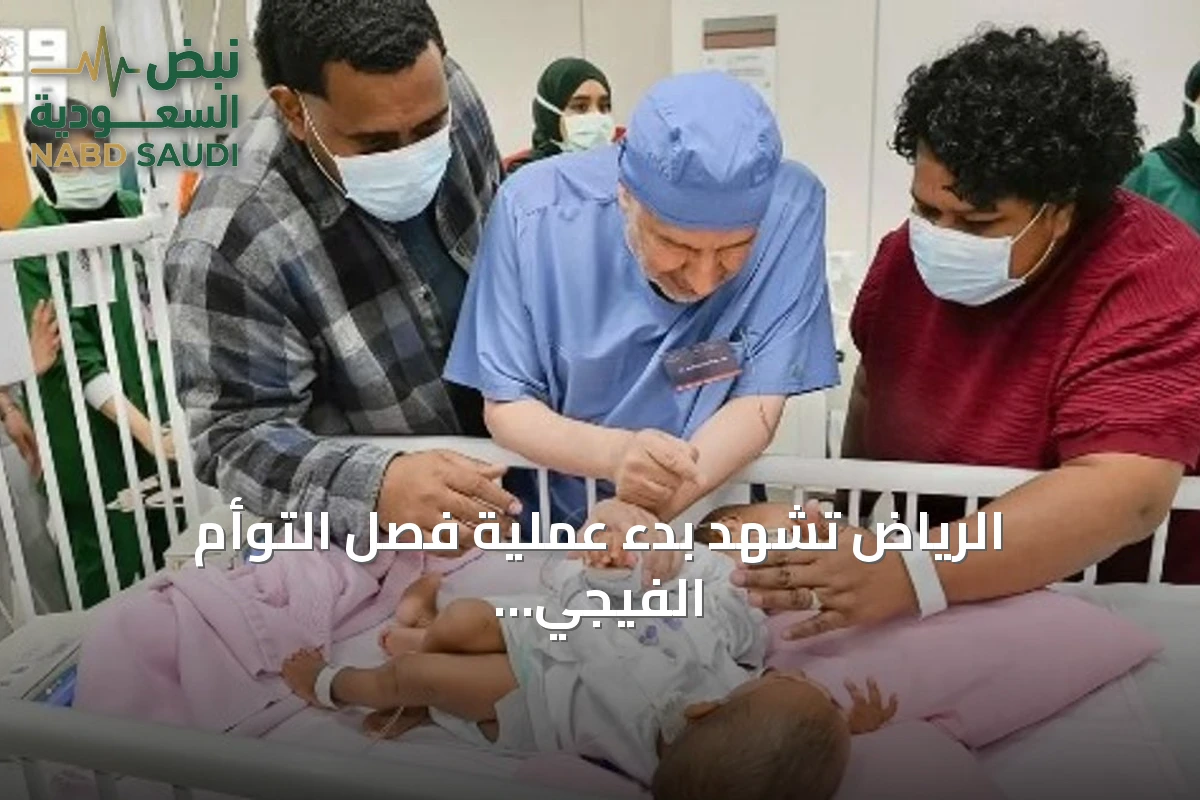 الرياض تشهد بدء عملية فصل التوأم الفيجي الملتصق