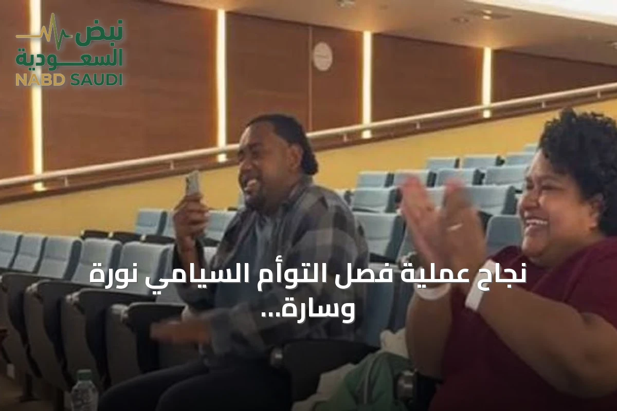 نجاح عملية فصل التوأم السيامي نورة وسارة من فيجي بعد جراحة معقدة بالمملكة