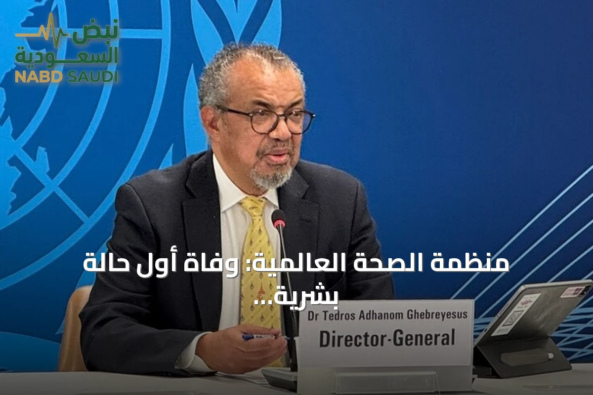 منظمة الصحة العالمية: وفاة أول حالة بشرية بفيروس شاموندا في فرنسا