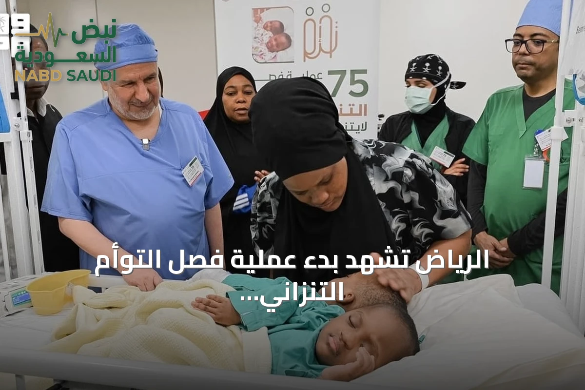 الرياض تشهد بدء عملية فصل التوأم التنزاني لايتيينس ولوفنس بتوجيه من القيادة السعودية
