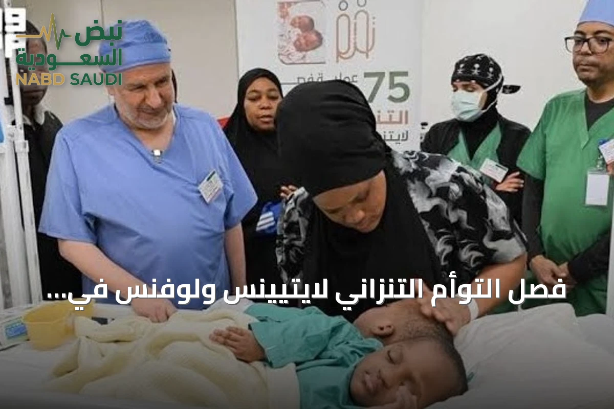 فصل التوأم التنزاني لايتيينس ولوفنس في عملية استغرقت 15 ساعة ضمن الحالة الـ75 للبرنامج السعودي